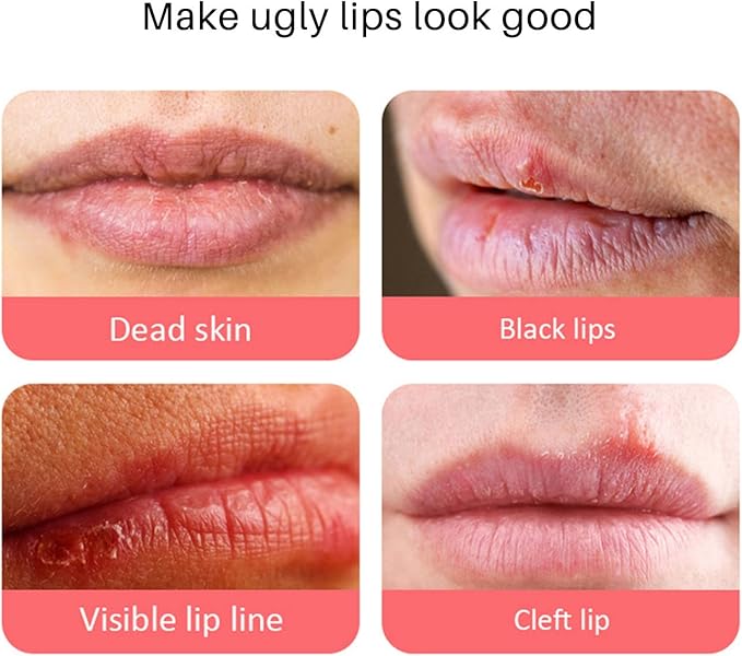 Lip Balm, Remove Dark Lip Portable Mild Easy To Apply Nourishing Lip Balm Brightening Lips Beeswax for Night for Women, facial skin care products