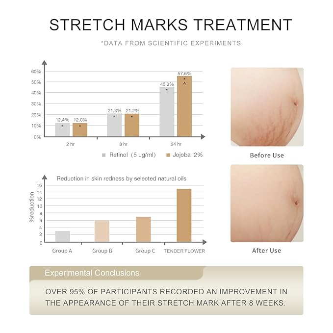 Stretch Mark Oil(110ml), body oil for Pregnancy,belly oil, belly abdominal Serum Skin Care,Moisturizing Dry Skin, Tender & Softening,True Belly Serum 3.7OZ