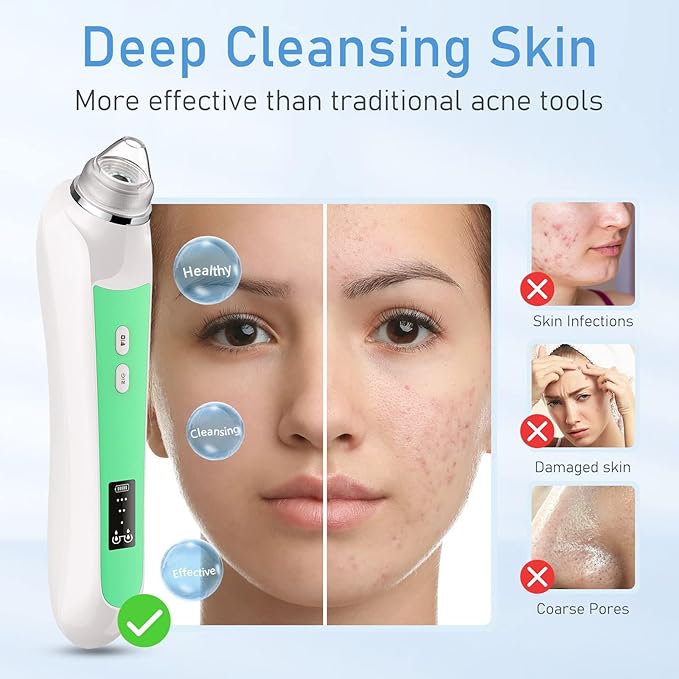 Facial Pore Blackhead Remover Vacuum, 1080P Camera Blackhead Remover, 20x Zoom, 8 LEDs & 3 Suction Modes, 800mAh Battery & USB - 6 Heads Pore Cleaner Kit for Women&Men(Green)