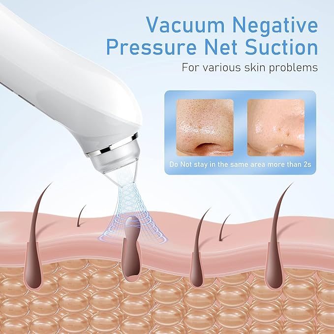 Facial Pore Blackhead Remover Vacuum, 1080P Camera Blackhead Remover, 20x Zoom, 8 LEDs & 3 Suction Modes, 800mAh Battery & USB - 6 Heads Pore Cleaner Kit for Women&Men(Blue)