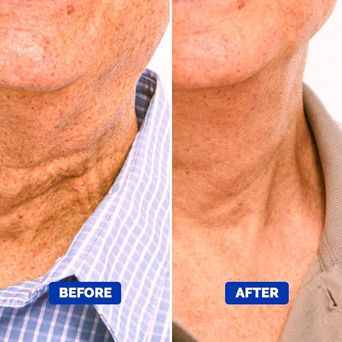 Particle Neck Cream for Men - Firming Cream, Lift and Moisturize The | Use on Saggy Skin or Turkey Anti Aging Triple Action with Collagen, Hyaluronic Acid, Retinol, 1 pack, 1.7 Fl Oz