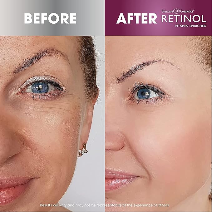 Retinol Super Face Lift - Visibly firms and tightens for a lifted, younger look. Infused, Vitamins C & E, this firming blend is a beauty “quick-fix”
