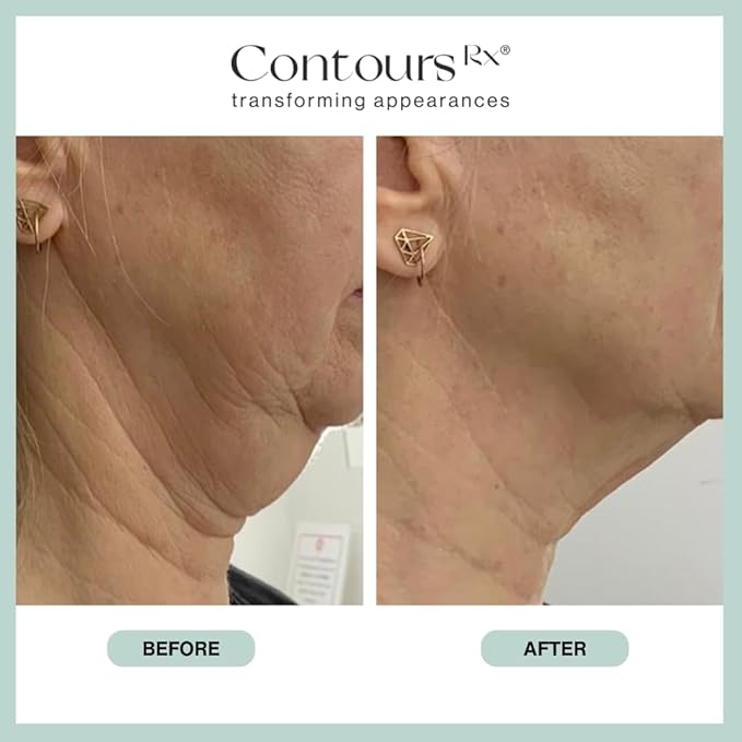 Neck Rescue Instant Correcting Strips – Invisible Lift Tape for Turkey Neck, Sagging Skin, and Wrinkles | Face & NeckTape Lifting for a Smooth, Tight Neckline – Long-Lasting Hold, 30 Count