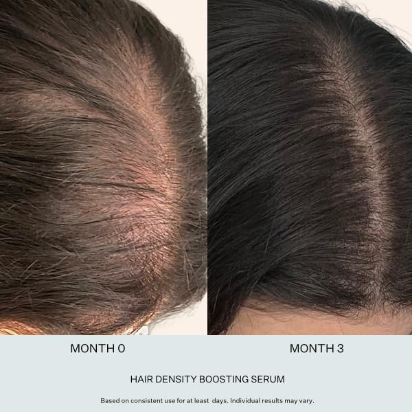 Multi-Peptide Serum for Men & Women - Helps Reduce Hair Loss - Strengthens & Thickens - Plant-Based - Combats Thinning Hair - Healthy Longer Hair - Root Awakening Morning (AM) - 28ml