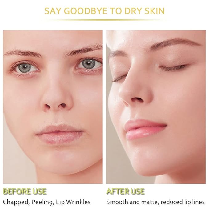 20Pcs Moisturizing Lip Mask, Restores Moisture Lip Care Mask for Dry Lips and Lip Lines Lips Overnight Lip Care, Gel Treatment Lip Masks Plumping Lips Mask (Yellow)