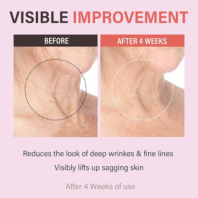 Retinol Collagen Lifting Neck Cream,Anti Aging Face and Neck Cream for Reduce Wrinkles and Hydrating & Lifting Neck,For Face, Neck, Décolleté Wrinkle Care, 1.76 oz.