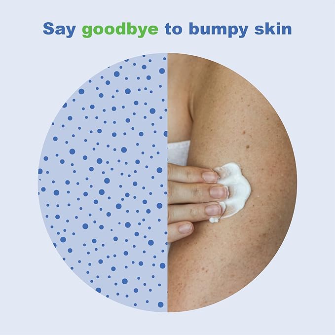 KP Elements Keratosis Pilaris Lotion (4 fl oz) - Natural Keratosis Pilaris Treatment, Moisturizing & Exfoliating AHA Lotion for KP, Vegan, Made in USA