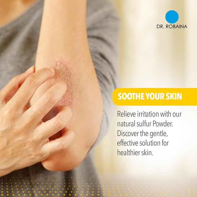 Dr. Robaina Sulfur Balsam Lotion – Lightweight Moisturizer for Dry, Flaky & Itchy Skin – Calms Redness, Supports Skin Barrier & Locks Hydration – Shea Butter & Tea Tree – 8 fl oz, USA Made