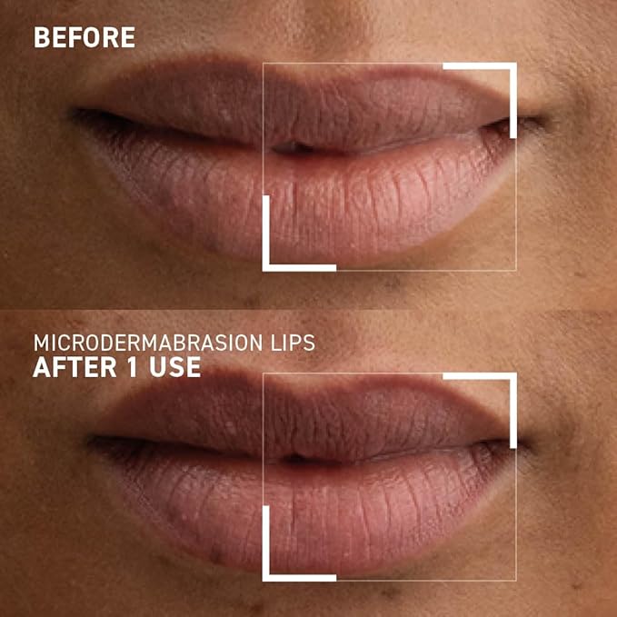 Dr. Brandt Microdermabrasion Smoothing Lip Scrub Gommage Lissant Levres 10 g / 0.35 oz