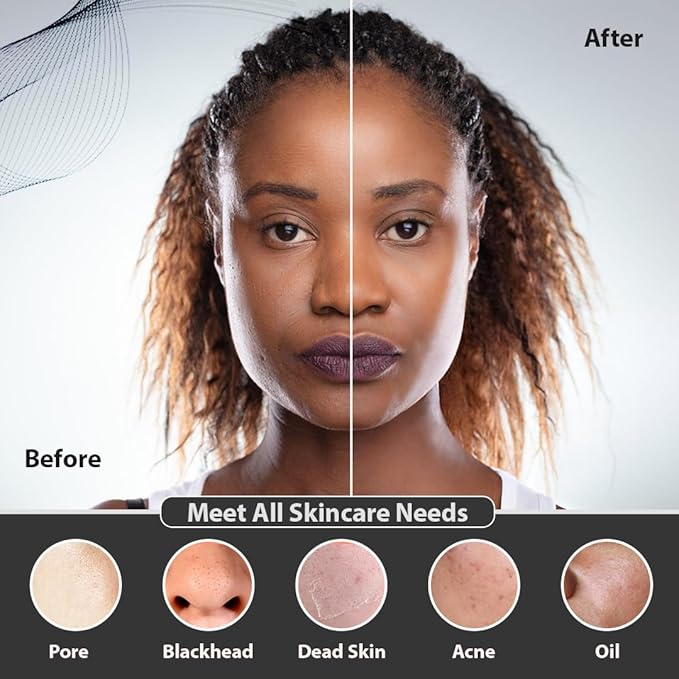 Facial Cleansing Brush | 3-in-1 Electric Face Scrubber | USB Rechargeable Face Cleansing Brush | IPX7 Waterproof | Blackhead Remover | Deep Cleansing & Exfoliating (Black)