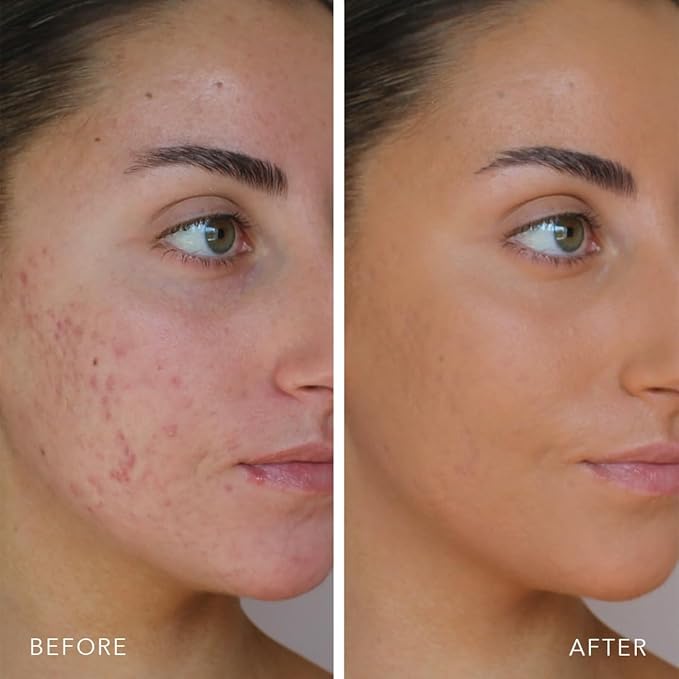 Doll 10 TCE Liquid Filter - Covers, Blurs, and Brightens (Rich)