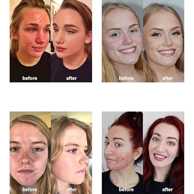 2 Pack PHOERA Foundation,Matte Oil Control Concealer Foundation Cream,PHOERA Long Lasting Waterproof Matte Liquid Foundation for Women Girls (102 Nude)