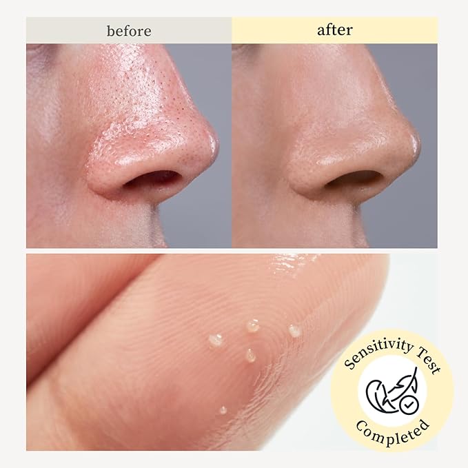 NOONI Facial Cleanser - Snow Aqua 0 LHA Toning Cleansing Oil | Makeup Blackhead Remover, Pore Control, Glass Skin, Help Control Sebum, Revitalizing, Moisturizing, Korean Skin Care, 6.76 Fl Oz (200 ml)