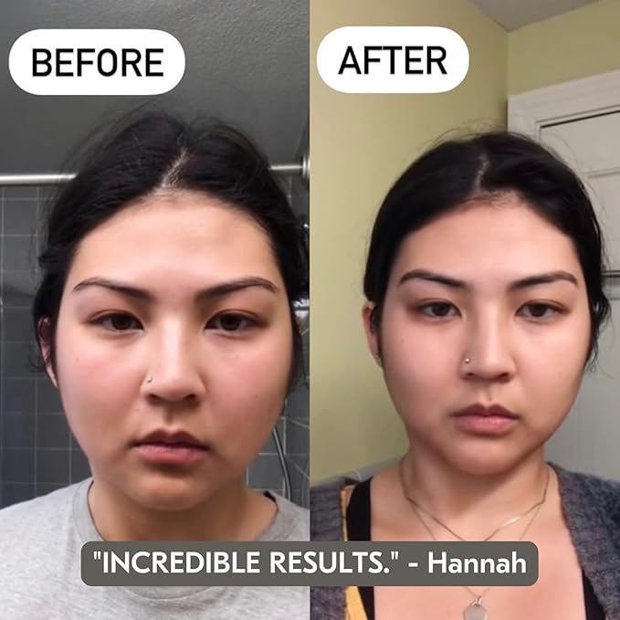 Mount Lai Stainless Steel Gua Sha Facial Tool – The Element of Refinement – Professional Grade Steel Face Sculpting Tool for Lymphatic Drainage, Puffiness Reduction & Refined Results