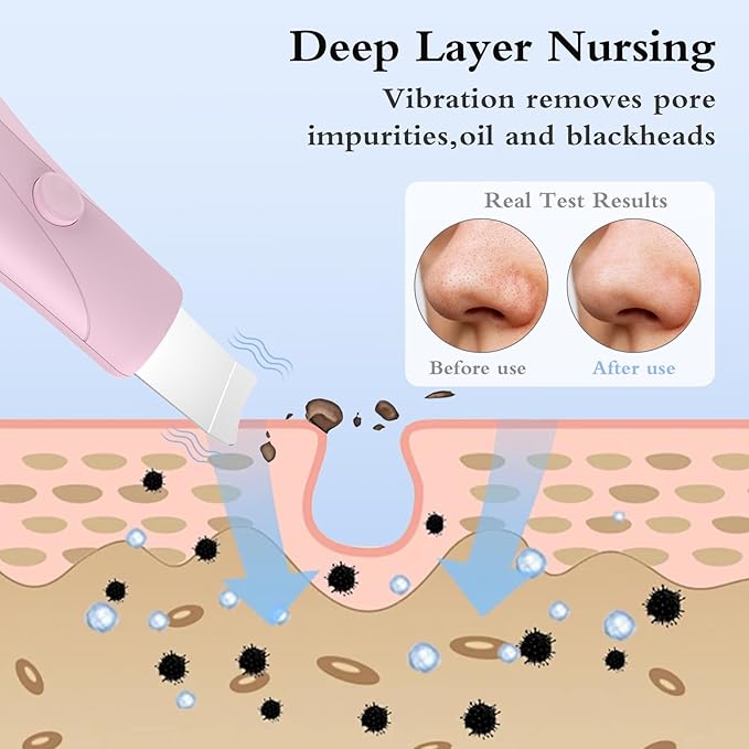 Skin Scrubber Face Spatula Skin Spatula Pore Cleaner Blackhead Remover Tools for Facial Deep Cleansing Skin Care Tool for Men and Women (Pink)