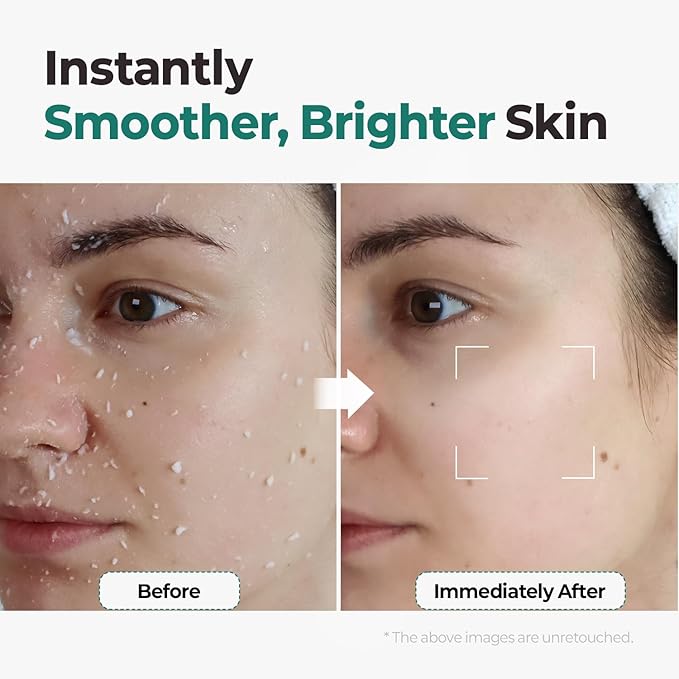 MOTHER MADE LHA Green Tea Exfoliating Aqua Peel Gel, Deep Pore Face Exfoliant, Gentle Facial Exfoliator, Dead Skin Remover, Natural Cellulose for Peeling, Vegan, Korean Skincare (100ml / 3.38 fl.oz)