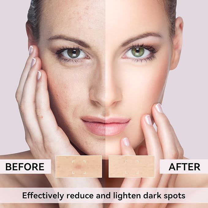 Dark Spot Remover for Face, Dark Spot Corrector for Age Spot Sun Spot Brown Spot Melasma Uneven Skin Tone, with Vitamin C and Hyaluronic Acid for Women and Men, 1.7 FL OZ