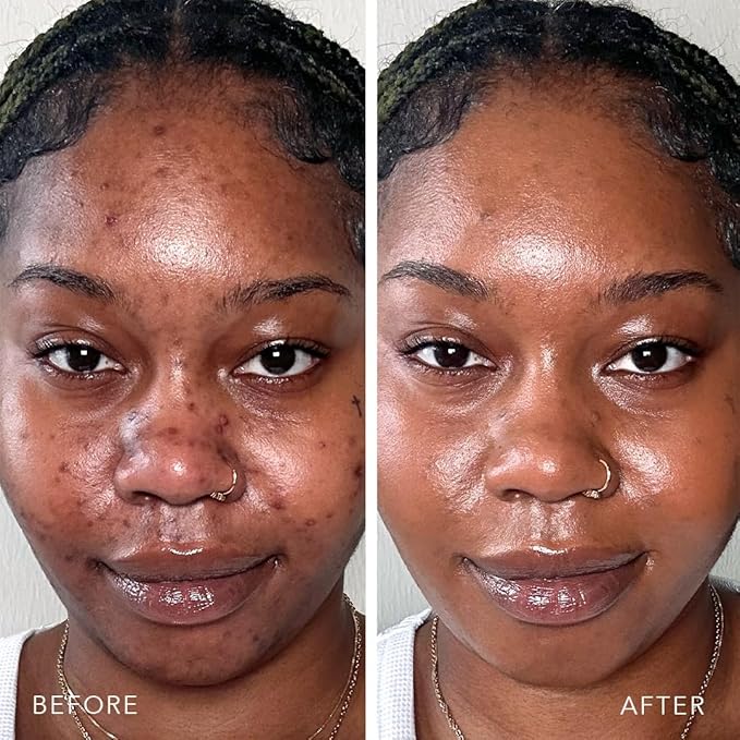 Doll 10 TCE Liquid Filter – CC Cream - Liquid Foundation - Lightweight Tinted Moisturizer & Skin Tint - Blurs Pores & Fine Lines - Vegan - Clean Makeup - [Tan/Deep] - 30 Day Supply