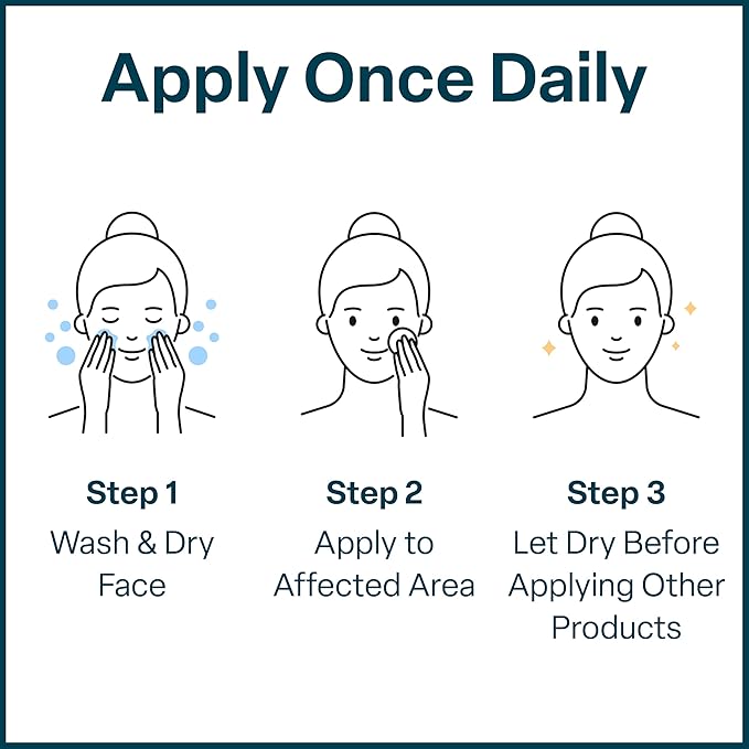 QRxLabs Salicylic & Glycolic Acid Acne Control Pads - 50 Count Jar - Glycolic & Salicylic - Bacne Treatment with Vitamins B5, C & E, Calendula & Green Tea