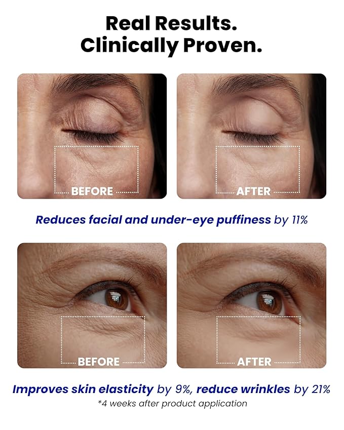 Ice Roll Serum | Cooling & Hydrating Roll-On Serum for Face, Puffy Eyes, Bakuchiol & Collagen for Firming & Wrinkles, Facial Roller for Depuffing, Under Eye Bag Treatment | Korean Skin Care