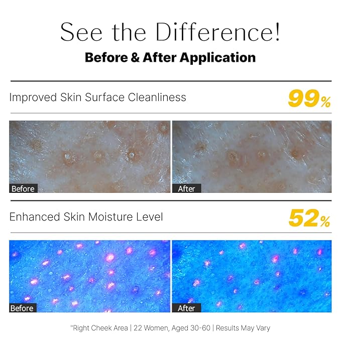 Honey Lemon Face Mask Wash-Off Pack & Scrub — 5-Minute, Exfoliating, Hydrating, Gentle for Sensitive Skin, with Manuka Honey & Lemon Extract, 3.52 oz (100 g)