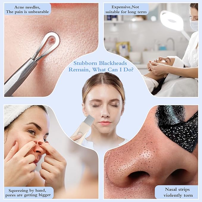 Skin Scrubber Face Spatula Skin Spatula Pore Cleaner Blackhead Remover Tools for Facial Deep Cleansing Skin Care Tool for Men and Women (Beige)