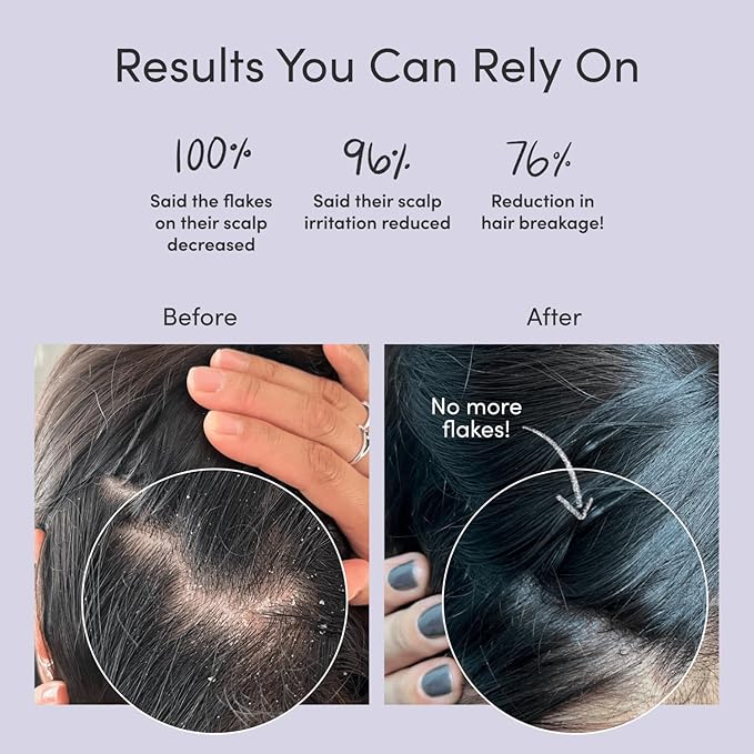 Jupiter Anti-Dandruff Shampoo, Conditioner, & Serum Advanced Set, Physician-Formulated for Dry, Itchy, Oily, Flaky Scalp Care, Color-Safe, Dry Scalp, Sulfate-Free