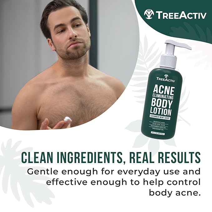 TreeActiv Acne Eliminating Body Lotion 8 fl oz | Clears Body, Back, Butt and Shoulder Acne | Anti-Acne Moisturizer | Prevents Future Breakouts | Cucumber Mint Scent