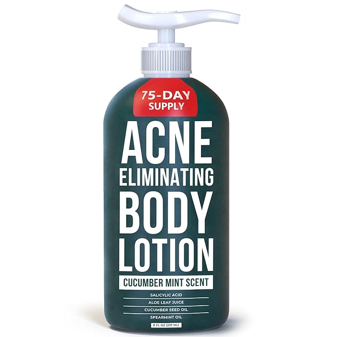 TreeActiv Acne Eliminating Body Lotion 8 fl oz | Clears Body, Back, Butt and Shoulder Acne | Anti-Acne Moisturizer | Prevents Future Breakouts | Cucumber Mint Scent