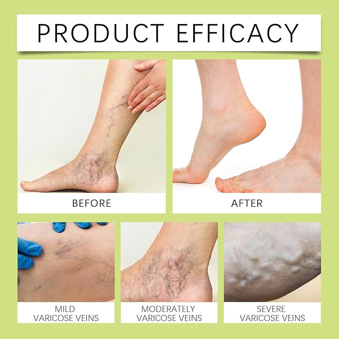 Miracle Balm, Soothing Balm for Joints, Back, Legs & Feet, Non-Greasy (3PCS)