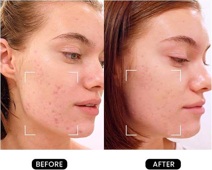 Revive Skincare for Anti-Aging, Glow Like Never Before,Multifunctional Beauty Device, Facial Massager for Home use