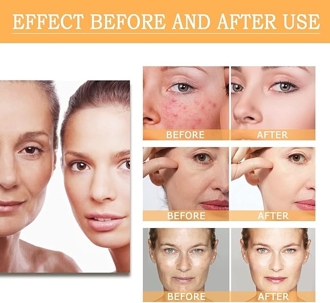 Glycolic Acid Toning Solution, Glycolic Acid 7% Toner, Glycolic Sour 7% Toning, KeepThe Skin Moist, Exfoliating Serum for Face, Facial Exfoliation Astringe Pores (240ML/8.0 Fl Oz)