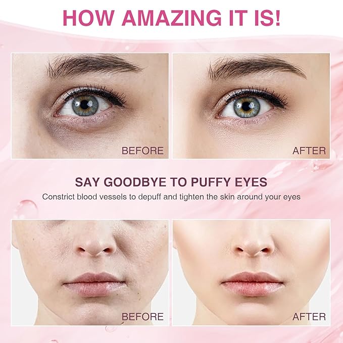 Facial Ice Roller for Skin Care - Aluminum Face Roller to De-Puff, Soothe & Tighten Pores - Cold Therapy Massage Tool for Radiant Glow