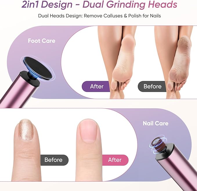 Electric Foot Callus Remover, 2in1 Rechargeable Foot File Callus Remover for Feet, 9 Speeds Foot Scrubber Dead Skin Pedicure Tools for Feet Heel Scraper for Cracked Heels with Sandpaper Discs