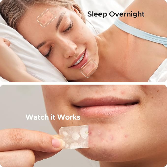 Large Acne Patches for Face, 7 Sizes Big Pimple Patches, XL Hydrocolloid Bandages for Body, Chin, Forehead, Nose, Back Blemish Zit Breakouts, Hydrocolloid Patch (Square, Strip, Dot 306 Count)