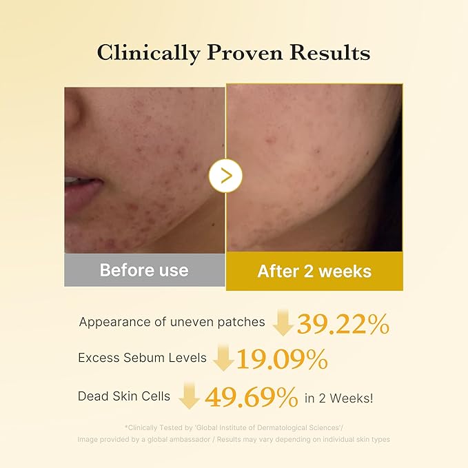 medicube Turmeric Clarifying Toner Pad for Troubled Skin & Use After Spot Care | Soothing & Calming with Turmeric, Niacinamide, Glycolic Acid | Korean Skin Care, 70 Pads