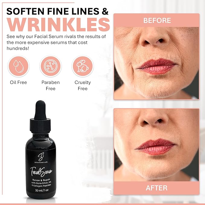 Facial Serum - Fight Blemishes - Acne Pimples & Breakouts - Soften Fine Lines & Wrinkles - Hydrate & Repair Damaged Skin - Clear Complexion - Collagen - 2 Types of Hyaluronic Acid - Anti Aging - 1oz