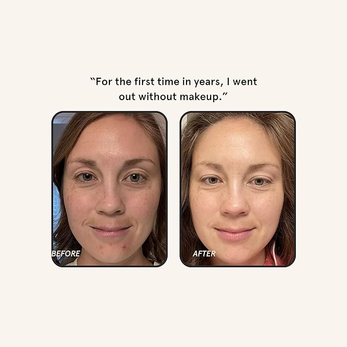 Barefaced Brightening Serum 1 Fl Oz Dark Spot Corrector with Kojic Acid, Arbutin, Azelaic Acid & Licorice, Anti-Aging, Hydrating, Fades Hyperpigmentation & Evens Skin Tone, Antioxidant-Powered Formula