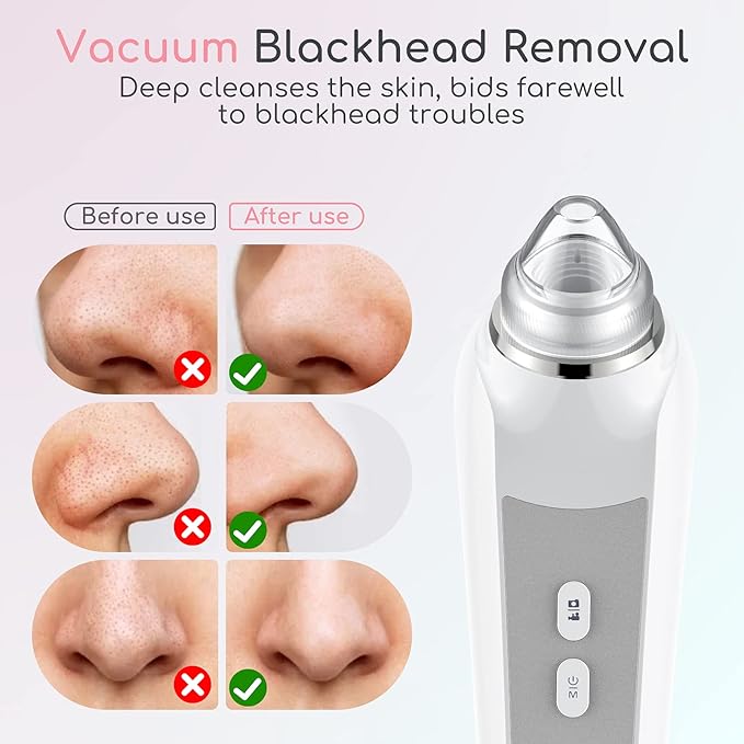 Blackhead Remover Vacuum, Black Head Remover for Face with Camera, Pore Vacuum for Men and Women, USB Interface Type Blackhead Remover Tools, 6 Suction Heads & 3 Adjustment Modes (Grey)