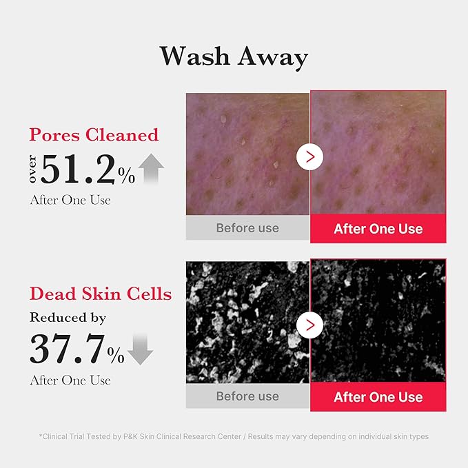 medicube Red Foam Cleanser - Deeply cleanses, remove impurities, control sebum, | Korean Skincare