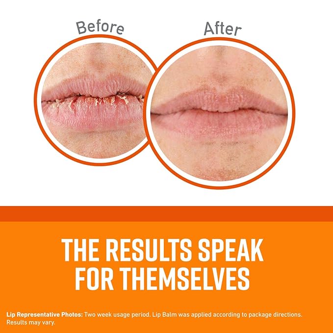 O'Keeffe's Unscented Lip Repair Lip Balm for Dry, Cracked Lips, Stick, (Pack of 7)