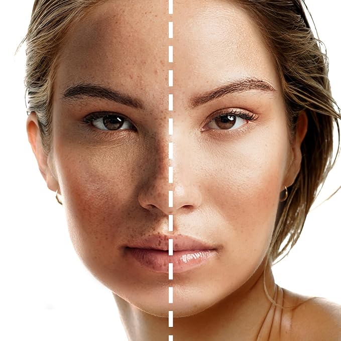 Color Correcting Concealer Cream Full Coverage Flawless Face Contour Palette Professional Makeup, Light to Medium