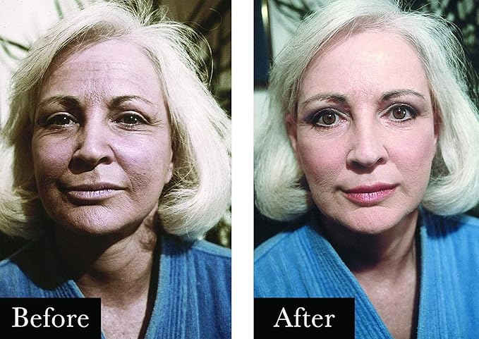 Boyd's Renoir No Lines Temporary Wrinkle Remover- For Forehead, Eyes, Lips, 0.5 fl oz (3-Pack)