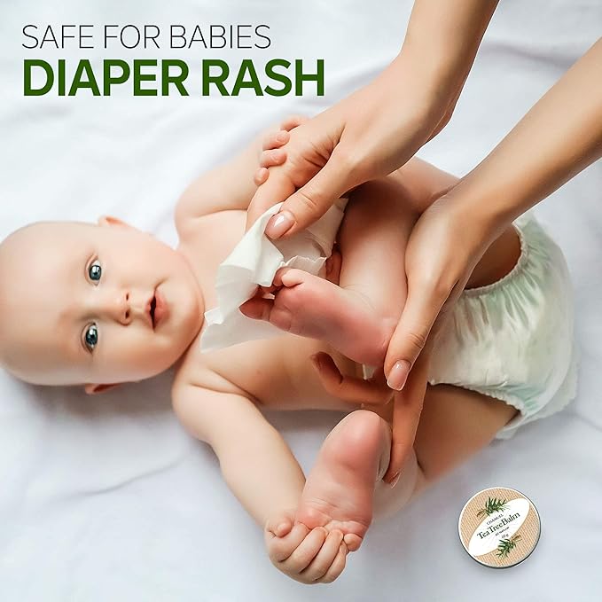 Tea Tree Oil Balm -100% All Natural | Great Cream for Soothing Irritations like Rashes, Insect Bites, Folliculitis, Acne, Itches, Dry Heels, Cuticles, Saddle Sores and more!