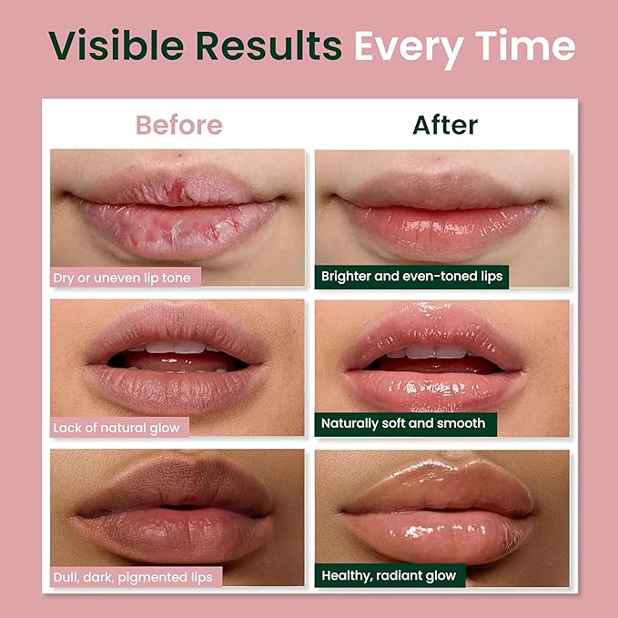 Vegan Lip Balm for Dull, Dark & Smokers' Lips | Naturally – Hydrating & Moisturizing - Antioxidant-Rich