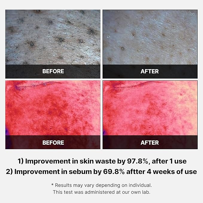 Medicube Red Succinic Acid Panthenol Facial Peeling Pads - Exfoliating Toner Pads for Breakout-Prone Skin with Niacinamide, AHA, BHA, and Soothing Panthenol - Non-Comedogenic