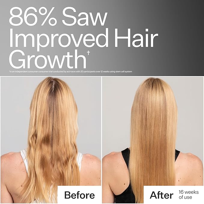 ACT+ ACRE Stem Cell Shampoo | Boosts Density, Hydrates Scalp, Removes Build-Up | Thicker, Fuller Looking Hair | Swiss Apple Stem Cells, Caffeine, Hyaluronic Acid | Vegan, Cold Processed® | 10 Fl Oz