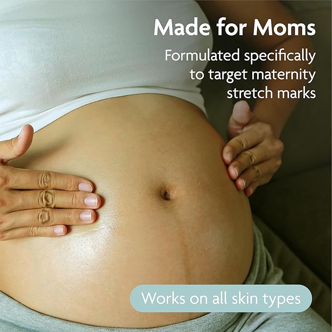 TriLASTIN Hydro-Thermal Accelerator - Moisturizer (3oz / 88ml) | Vitamin-Infused Skin Serum | Pregnancy and Postpartum Skin Care for Stretch Mark Prevention | Hypoallergenic and Paraben-Free Formula