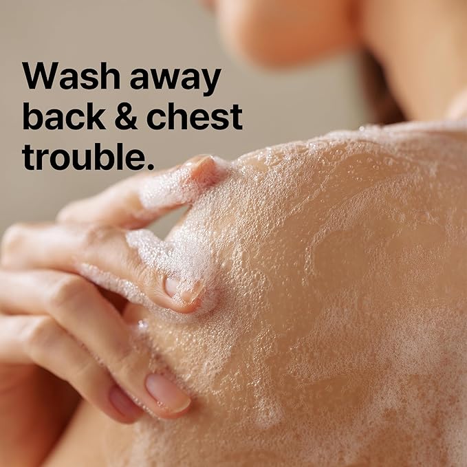 SOME BY MI AHA BHA PHA 30 Days Miracle Acne Clear Body Cleanser - Pack of 2 - Daily Exfoliating Tea Tree Acne Body Wash with Salicylic Acid - Deep Cleanses Sebum and Impurities - Korean Skin Care