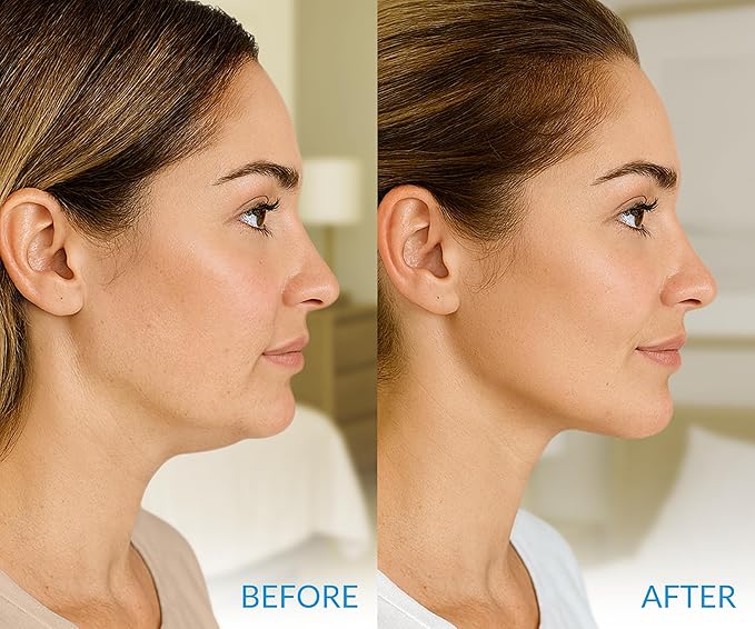 Stylia MaxiLift V-Line Lifting Collagen Face Mask – Enhanced Double Chin Reducer – Jawline Shaper Face Lifting Masks – Firming Neck Lift Collagen Mask – Chin Strap for Sleeping – Hyaluronic, Aloe 10PC